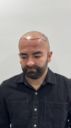 Önce