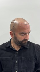Önce